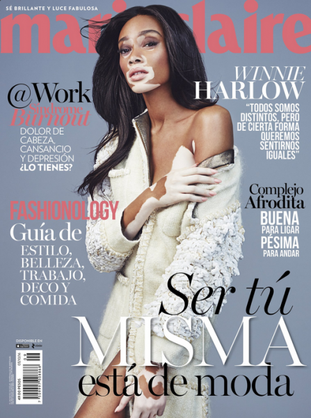 Winnie-Harlow-Covers-The-September-2016-Issue-Of-Marie-Claire-M%C3%A9xico-1-447x600.png