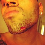 He Took A Blow To The Chin: Chris Brown Injured By Drake & His Goonies  